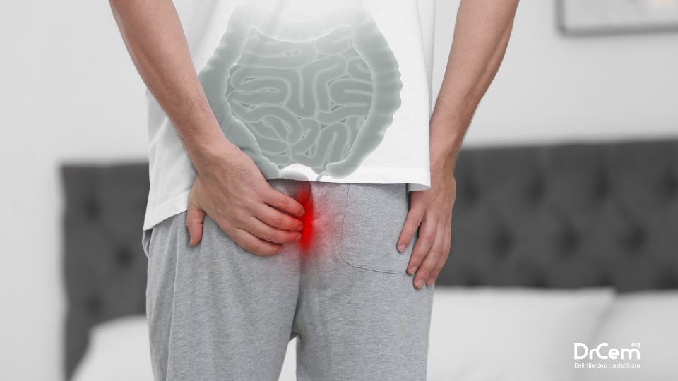 Perianal Apse görseli - DrCem hastalık rehberi